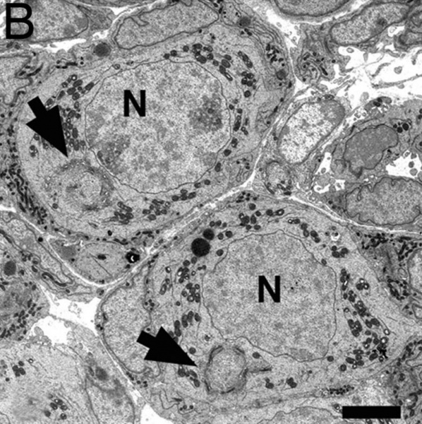 File:Mouse neonatal ovary oocyte EM03.jpg