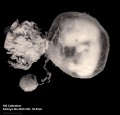 Embryo, amnionic sac, chorionic villi and yolk sac