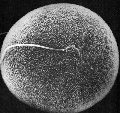 Hamster oocyte and spermatozoa.jpg