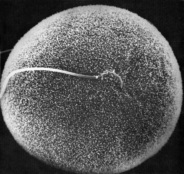 File:Hamster oocyte and spermatozoa.jpg