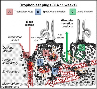 Spiral artery trophoblast plug cartoon1.jpg