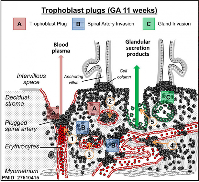 File:Spiral artery trophoblast plug cartoon1.jpg