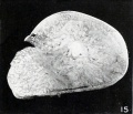 Fig. 15. Full-term nodule accompanying a twin donated by Dr. Slemona. No. 1682.