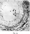 Fig. 19. Portion of the blastocyst in Section 4.4.6.