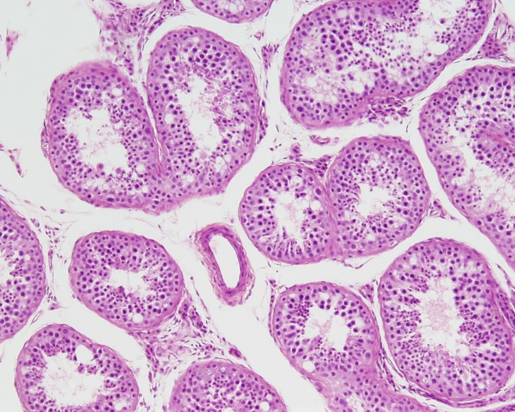 File:Testis, young H&E reproductive system, male, convoluted seminiferous tubules x10.jpg