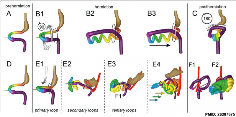 File:Human intestine “en-bloc rotation” model.jpg