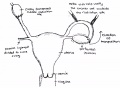 Laparoscopic lateral ovarian transposition