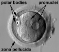 Human zygote two pronuclei (labelled) PMID 20579351