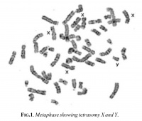 Male tetrasomy X karyotype.jpg