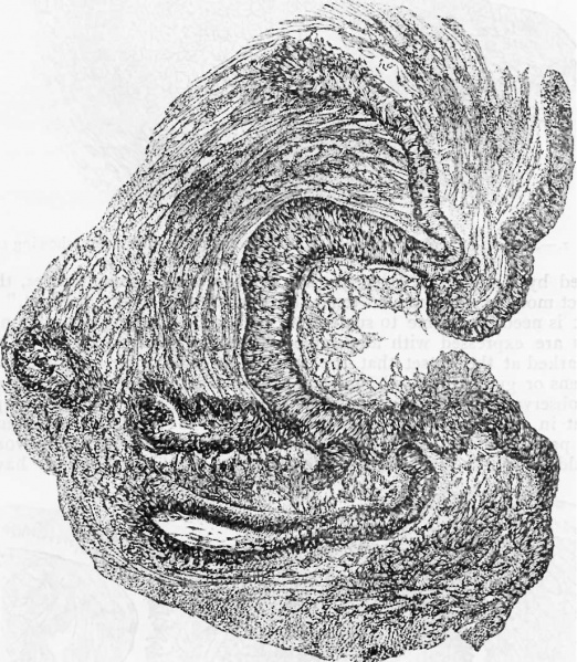 File:Bowlby1882 fig03.jpg