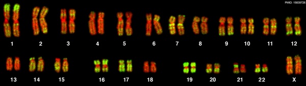 Human female karyotype