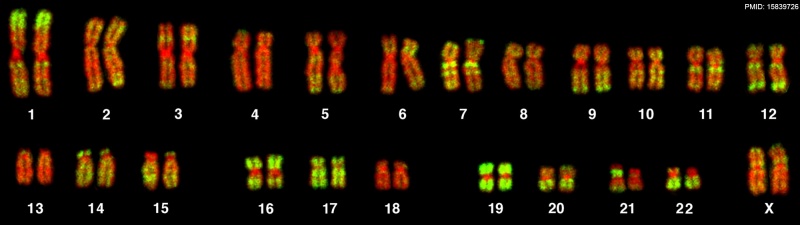 Human female karyotype