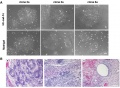 Human induced pluripotent_stem_cells