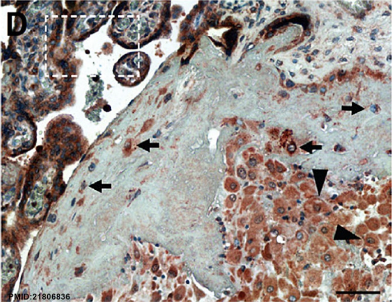 File:Human placenta SERPINE2 expression 03.jpg