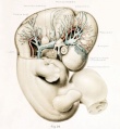 Right profile view human embryo 11.5 mm long]]
