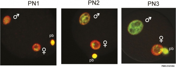 Zygote pronuclei stages