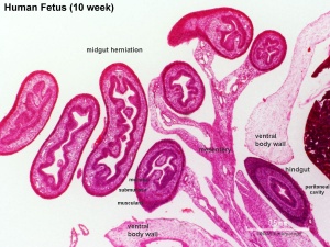 Human week 10 fetus 26.jpg