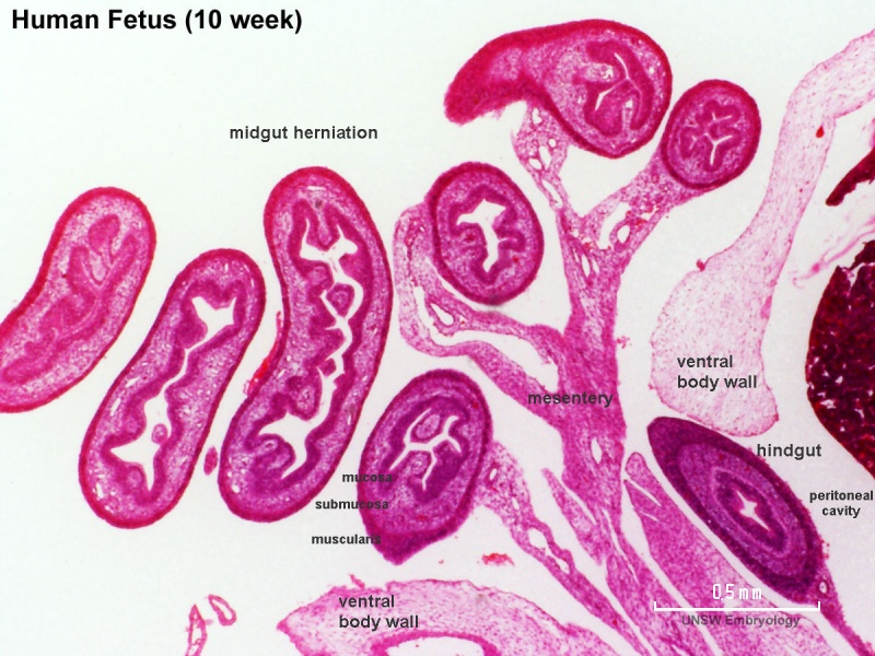 File:Human week 10 fetus 26.jpg