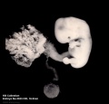 Embryo, chorionic villi and yolk sac