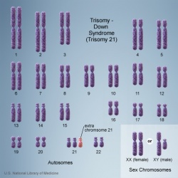Chromosome- trisomy.jpg