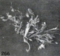 Fig. 266. Transitional hydatiform villi. No. 437. X2.25.