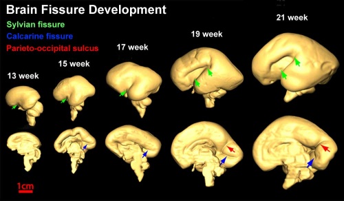 Brain fissure development 02.jpg