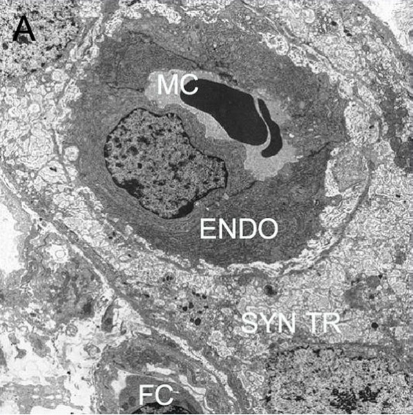 File:Endotheliochorial placenta EM01.jpg