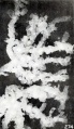 Fig. 274. Villous tree with knobbed villi. No. 2372. X6.75.