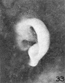 Fig. 33. Embryo No. 2144, 45.5 mm. (R.)
