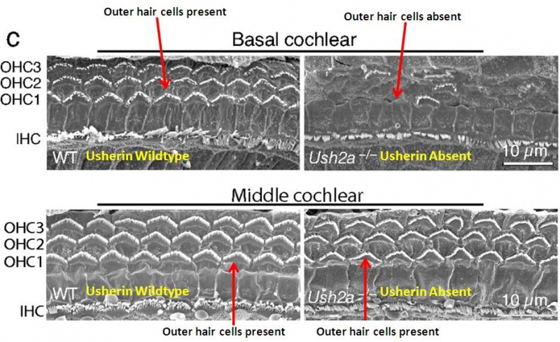 File:Basal Cochlear Outer Hair Cells.jpg