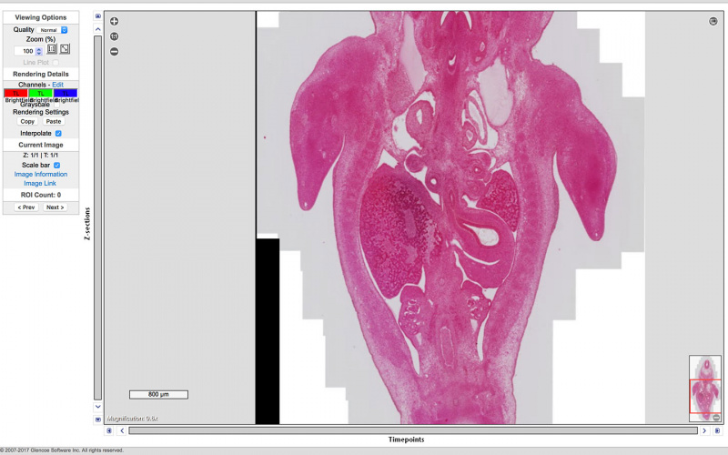 File:Embryo-1951-09-01-Slide-60 Scene11-1.jpg