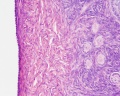 Ovary histology (monkey) showing the tunica albuginea and primordial follicles