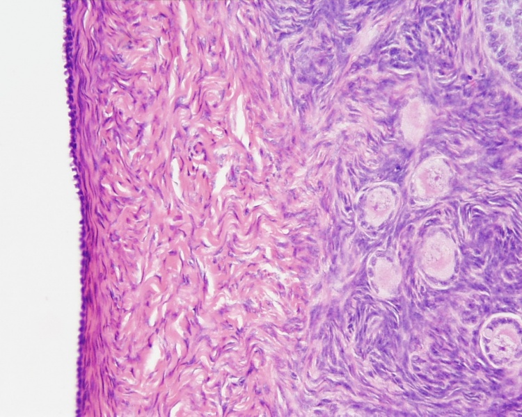 File:Ovary Histology - tunica albuginea.jpg