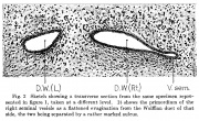 Ductus Deferens Development - Embryology