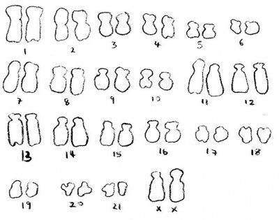 Drawn chromosome.jpg