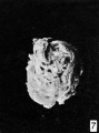 Fig. 7. Hydatiform chorionic vesicle in loco with the tube incised. No. 2052. X 2.