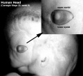 Fig 10 Human embryo eyelid development - UNSW image