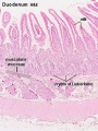 Duodenum villi and crypts