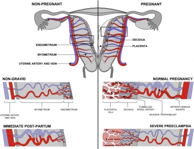 Uterine and placental vasculature.jpg