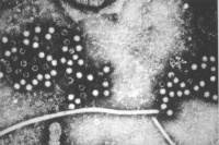 Hepatitis E virus.jpg