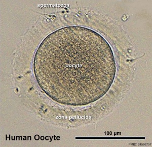 Human oocyte 11.jpg