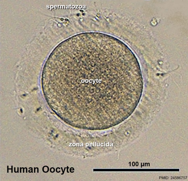 File:Human oocyte 11.jpg