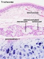 Trachea (detail glands)