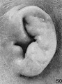 Fig. 50. Embryo No. 2274, 113 mm. (R.)