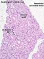 Thumbnail for version as of 15:01, 26 March 2014