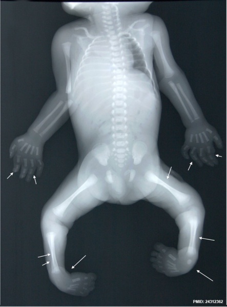 File:Human fetus skeleton x-ray 02.jpg