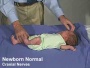Newborn-cranial-nerves.jpg