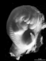 Blechschmidt Collection - Embryology