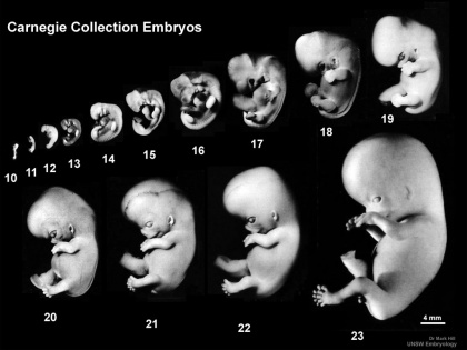 Carnegie Collection Embryos