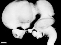Fig 12 Left lateral view of embryonic CNS - UNSW image
